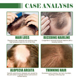 Dense Hair Oil Moisturizing Soft Hair Repair